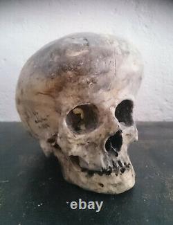 Crâne humain hydrocéphale, human skull, curiosité, curiosity, replica, anomalie