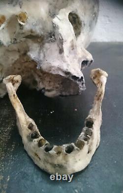 Crâne humain hydrocéphale, human skull, curiosité, curiosity, replica, anomalie